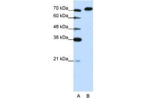 Human Jurkat; WB Suggested Anti-AKAP8L Antibody Titration: 1. (AKAP8L 抗体  (C-Term))