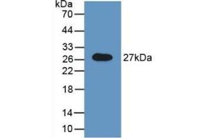 Detection of Recombinant GAS, Rat using Polyclonal Antibody to N-Acetylgalactosamine-6-Sulfatase (GALNS) (GALNS 抗体  (AA 172-381))