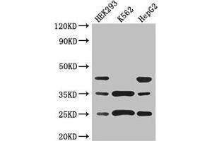 Western Blot Positive WB detected in: HEK293 whole cell lysate, K562 whole cell lysate, HepG2 whole cell lysate All lanes: PCTP antibody at 3 μg/mL Secondary Goat polyclonal to rabbit IgG at 1/50000 dilution Predicted band size: 25, 17 kDa Observed band size: 25, 35, 45 kDa (PCTP 抗体  (AA 1-214))