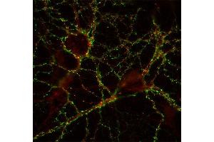 Immunocytochemistry (ICC) image for anti-gamma-aminobutyric Acid (GABA) A Receptor, beta 3 (GABRB3) (AA 344-429) antibody (ABIN1742464)