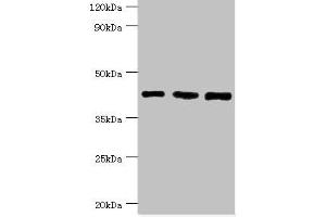 Western Blotting (WB) image for anti-SWI/SNF Related, Matrix Associated, Actin Dependent Regulator of Chromatin, Subfamily B, Member 1 (SMARCB1) (AA 86-385) antibody (ABIN7171070)