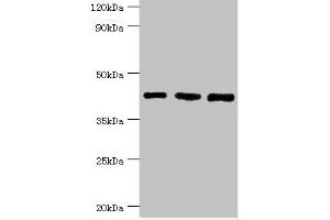 Western blot All lanes: SWI/SNF-related matrix-associated actin-dependent regulator of chromatin subfamily B member 1 antibody at 8 μg/mL Lane 1: Hela whole cell lysate Lane 2: 293T whole cell lysate Lane 3: Mouse stomach tissue Secondary Goat polyclonal to rabbit IgG at 1/10000 dilution Predicted band size: 45, 44 kDa Observed band size: 45 kDa (SMARCB1 抗体  (AA 86-385))