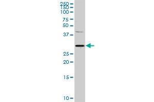 PITX1 MaxPab rabbit polyclonal antibody. (PITX1 抗体  (AA 1-314))