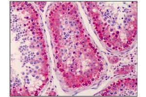 Human Testis: Formalin-Fixed, Paraffin-Embedded (FFPE) (NANOS3 抗体  (C-Term))