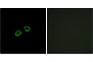 Immunofluorescence analysis of A549 cells, using ARFGEF2 Antibody. (ARFGEF2 抗体  (AA 1491-1540))