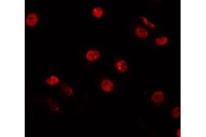 ABIN6266847 staining HepG2 by IF/ICC. (HNF4 alpha/gamma 抗体)