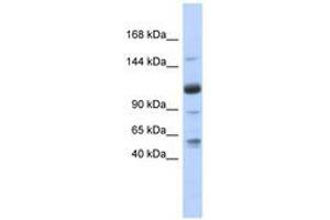Image no. 1 for anti-U2-Associated SR140 Protein (SR140) (AA 71-120) antibody (ABIN6740719) (SR140 抗体  (AA 71-120))
