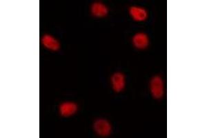 ABIN6267046 staining HepG2 by IF/ICC. (H1FOO 抗体  (Internal Region))