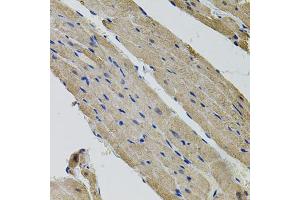 Immunohistochemistry of paraffin-embedded rat heart using ALDH9A1 antibody (ABIN5995392) (40x lens). (ALDH9A1 抗体)
