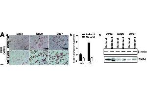BMP4 expression is elevated during Oleic acid-induced triglyceride/lipid accumulation in hepatocytes and in a mouse model of NAFLD.