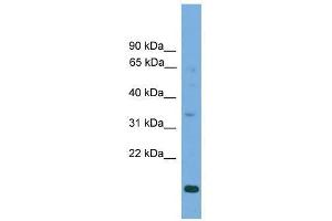 Western Blot showing SLC25A44 antibody used at a concentration of 1-2 ug/ml to detect its target protein. (SLC25A44 抗体  (Middle Region))