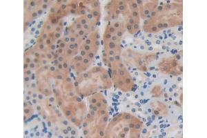 Used in DAB staining on fromalin fixed paraffin- embedded kidney tissue (EPB41 抗体  (AA 211-498))
