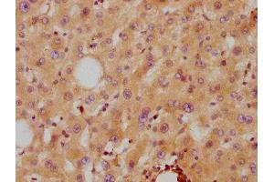 IHC image of ABIN7127342 diluted at 1:87. (Recombinant APOA2 抗体)