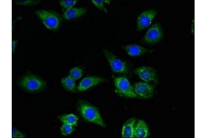 Immunofluorescent analysis of A549 cells using ABIN7149920 at dilution of 1:100 and Alexa Fluor 488-congugated AffiniPure Goat Anti-Rabbit IgG(H+L) (QDPR 抗体  (AA 2-244))