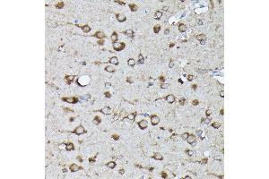 Immunohistochemistry of paraffin-embedded rat brain using Phospho-KRAS-S89 Rabbit pAb (ABIN7267530) at dilution of 1:100 (40x lens). (K-RAS 抗体  (pSer89))
