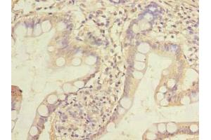 Immunohistochemistry of paraffin-embedded human small intestine tissue using ABIN7155745 at dilution of 1:100 (HOXC11 抗体  (AA 10-304))