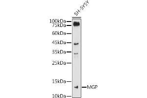 Western blot analysis of extracts of SH-SY5Y cells, using MGP antibody (ABIN6128268, ABIN6143825, ABIN6143826 and ABIN6221090) at 1:1000 dilution.