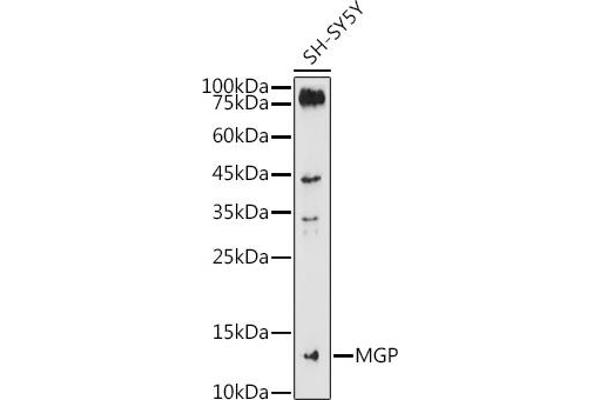 MGP Antikörper  (AA 20-103)