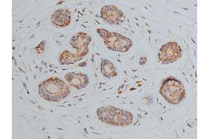 Immunohistochemistry (IHC) image for anti-POU Class 5 Homeobox 1 (POU5F1) (Internal Region) antibody (ABIN6259646)