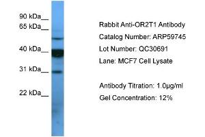 Western Blotting (WB) image for anti-Similar To Olfactory Receptor, Family 2, Subfamily T, Member 1 (OR2T1) (C-Term) antibody (ABIN2788190)