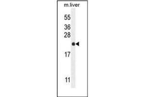 Western blot analysis of hCG_2024410 Antibody (C-term) in mouse liver tissue lysates (35ug/lane). (hCG_2024410 (AA 187-215), (C-Term) 抗体)