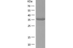 Western Blotting (WB) image for Zinc Binding Alcohol Dehydrogenase Domain Containing 2 (ZADH2) (AA 33-377) protein (His tag) (ABIN7125765) (ZADH2 Protein (AA 33-377) (His tag))