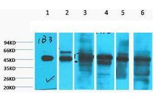Western Blot (WB) analysis of 1) HepG2, 2) HeLa, 3) Mouse Liver tissue, 4) C2C12, 5) Rat Heart tissue, 6) Mouse Skeletal Muscle tissue, diluted at 1:2000. (Cytokeratin 18 抗体)