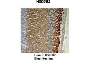 Sample Type :  Monkey adrenal gland   Primary Antibody Dilution :   1:25   Secondary Antibody:  Anti-rabbit-HRP   Secondary Antibody Dilution:   1:1000   Color/Signal Descriptions:  Brown: HSD3B2 Blue: Nucleus   Gene Name:  HSD3B2   Submitted by:  Jonathan Bertin, Endoceutics Inc. (HSD3B2 抗体  (N-Term))