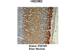 Sample Type :  Monkey adrenal gland   Primary Antibody Dilution :   1:25   Secondary Antibody:  Anti-rabbit-HRP   Secondary Antibody Dilution:   1:1000   Color/Signal Descriptions:  Brown: HSD3B2 Blue: Nucleus   Gene Name:  HSD3B2   Submitted by:  Jonathan Bertin, Endoceutics Inc.