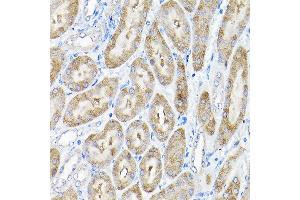 Immunohistochemistry of paraffin-embedded mouse kidney using THUMPD3 Rabbit pAb (ABIN6132951, ABIN6149133, ABIN6149134 and ABIN6214652) at dilution of 1:200 (40x lens). (THUMPD3 抗体  (AA 1-250))
