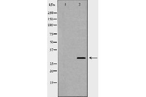 Western blot analysis of extracts of Hela , using KLK1 antibody. (Kallikrein 1 抗体  (Internal Region))
