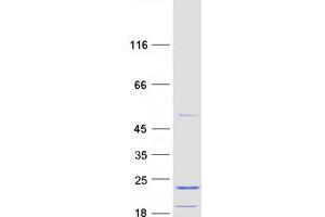 MRPL43 Protein (Transcript Variant 1) (Myc-DYKDDDDK Tag)