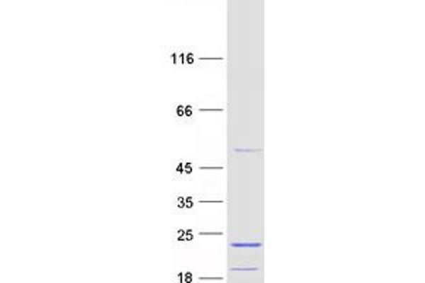 MRPL43 Protein (Transcript Variant 1) (Myc-DYKDDDDK Tag)