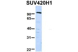 Western Blotting (WB) image for anti-Suppressor of Variegation 4-20 Homolog 1 (SUV420H1) (Middle Region) antibody (ABIN2775877)