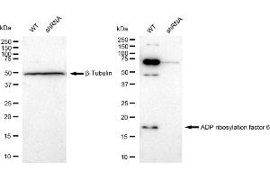 Western blotting analysis using ADP ribosylation factor 6 antibody (ABIN7797532).