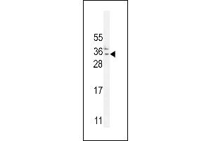 C Antibody (N-term) (ABIN654735 and ABIN2844423) western blot analysis in MDA-M cell line lysates (35 μg/lane). (C11orf73 抗体  (N-Term))