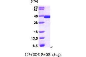 SDS-PAGE (SDS) image for Thymidylate Synthetase (TYMS) (AA 1-313) protein (His tag) (ABIN666924)