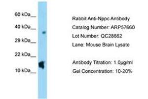 anti-Natriuretic Peptide Type C (NPPC) (AA 71-120) antibody