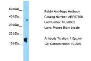 Image no. 1 for anti-Natriuretic Peptide Type C (NPPC) (AA 71-120) antibody (ABIN6749943) (NPPC 抗体  (AA 71-120))