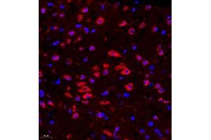 Immunofluorescence (Paraffin-embedded Sections) (IF (p)) image for anti-Ras-Related C3 Botulinum Toxin Substrate 3 (Rho Family, Small GTP Binding Protein Rac3) (RAC3) antibody (ABIN7075378)
