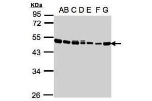 WB Image Sample(30μg whole cell lysate) A: 293T B: A431 , C: H1299 D: HeLa S3 , E: Hep G2 , F: MOLT4 , G: Raji , 10% SDS PAGE antibody diluted at 1:1000 (EEF1A2 抗体)