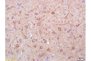 Formalin-fixed and paraffin embedded rat brain labeled with Rabbit Anti DDC/DOPA Decarboxylase Polyclonal Antibody, Unconjugated (ABIN725945) at 1:200 followed by conjugation to the secondary antibody and DAB staining (DDC 抗体  (AA 201-300))