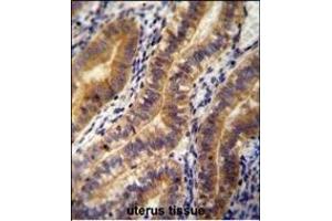 Immunohistochemistry (Paraffin-embedded Sections) (IHC (p)) image for anti-Angiopoietin 2 (ANGPT2) (AA 404-432), (C-Term) antibody (ABIN654062)