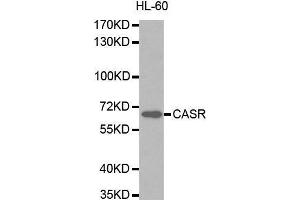 Western blot analysis of extracts of HL-60 cells lines, using CASR antibody. (CASR 抗体  (AA 874-1088))