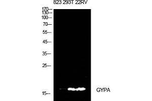 Western Blot (WB) analysis of 823, 293T, 22RV cells using CD235a Polyclonal Antibody. (CD235a/GYPA 抗体  (Internal Region))