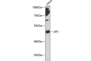 Western blot analysis of extracts of HeLa cells, using ZP3 antibody (ABIN6134464, ABIN6150536, ABIN6150538 and ABIN6217045) at 1:3000 dilution. (Zona Pellucida Glycoprotein 3 抗体  (AA 250-350))