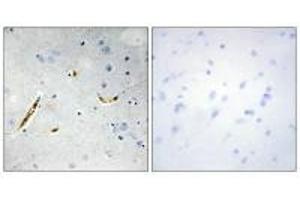 Immunohistochemistry analysis of paraffin-embedded human brain tissue using TCF3 antibody. (TCF3 抗体  (C-Term))