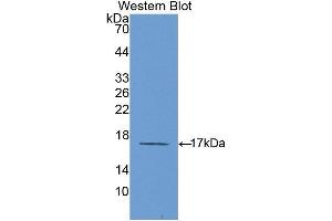 Western Blotting (WB) image for anti-Interleukin 6 Receptor (IL6R) (AA 214-348) antibody (ABIN3206014) (IL-6 Receptor 抗体  (AA 214-348))