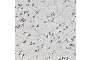 Immunohistochemistry of paraffin-embedded rat brain using FOXO3 antibody (ABIN5974623) at dilution of 1/100 (40x lens). (FOXO3 抗体)