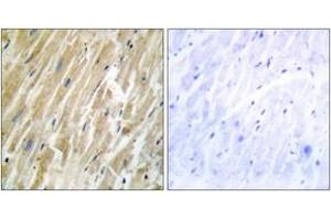 Immunohistochemistry (IHC) image for anti-Calreticulin (CALR) (AA 21-70) antibody (ABIN2889442) (Calreticulin 抗体  (AA 21-70))